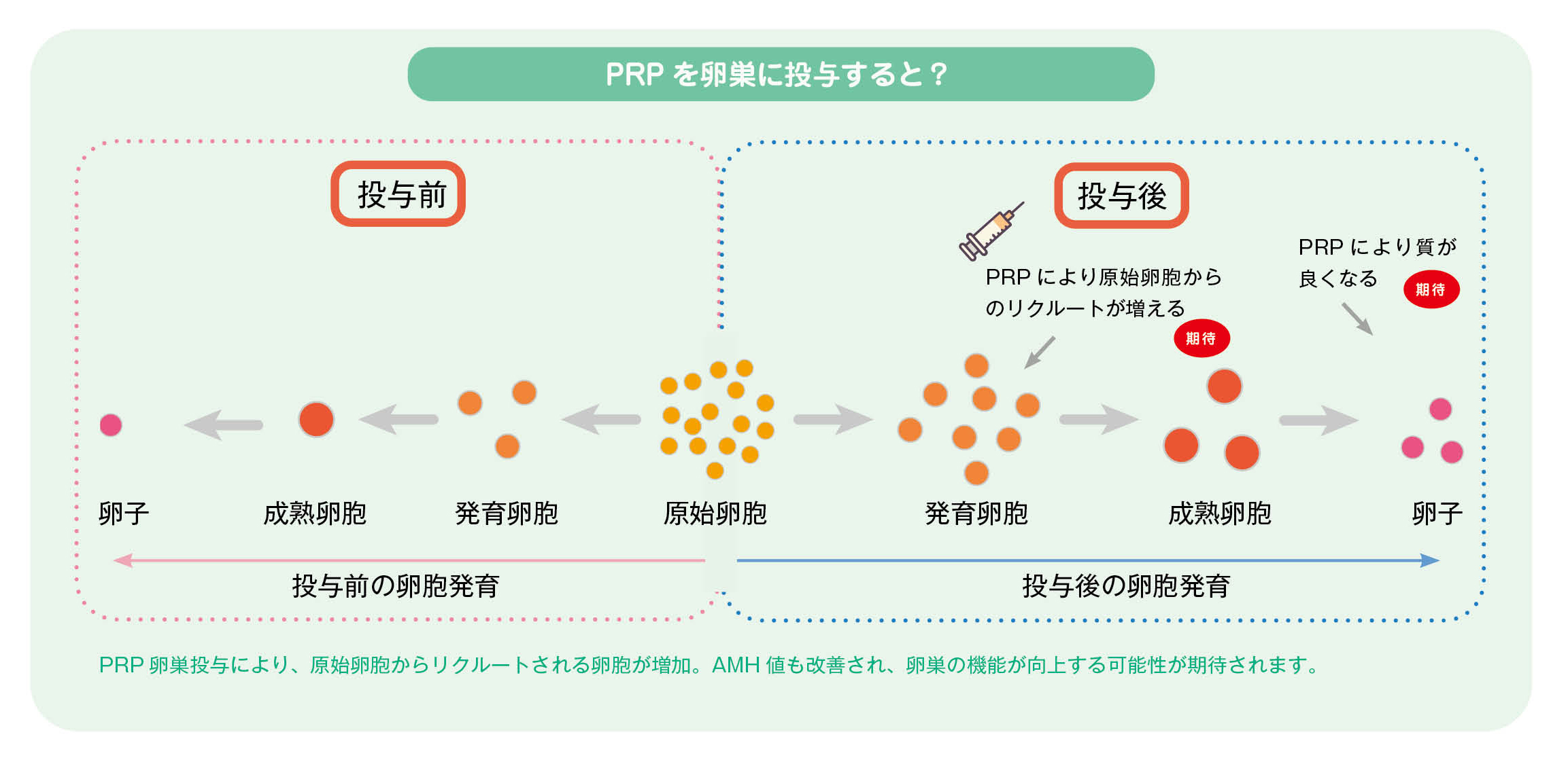 PRP治療の方法